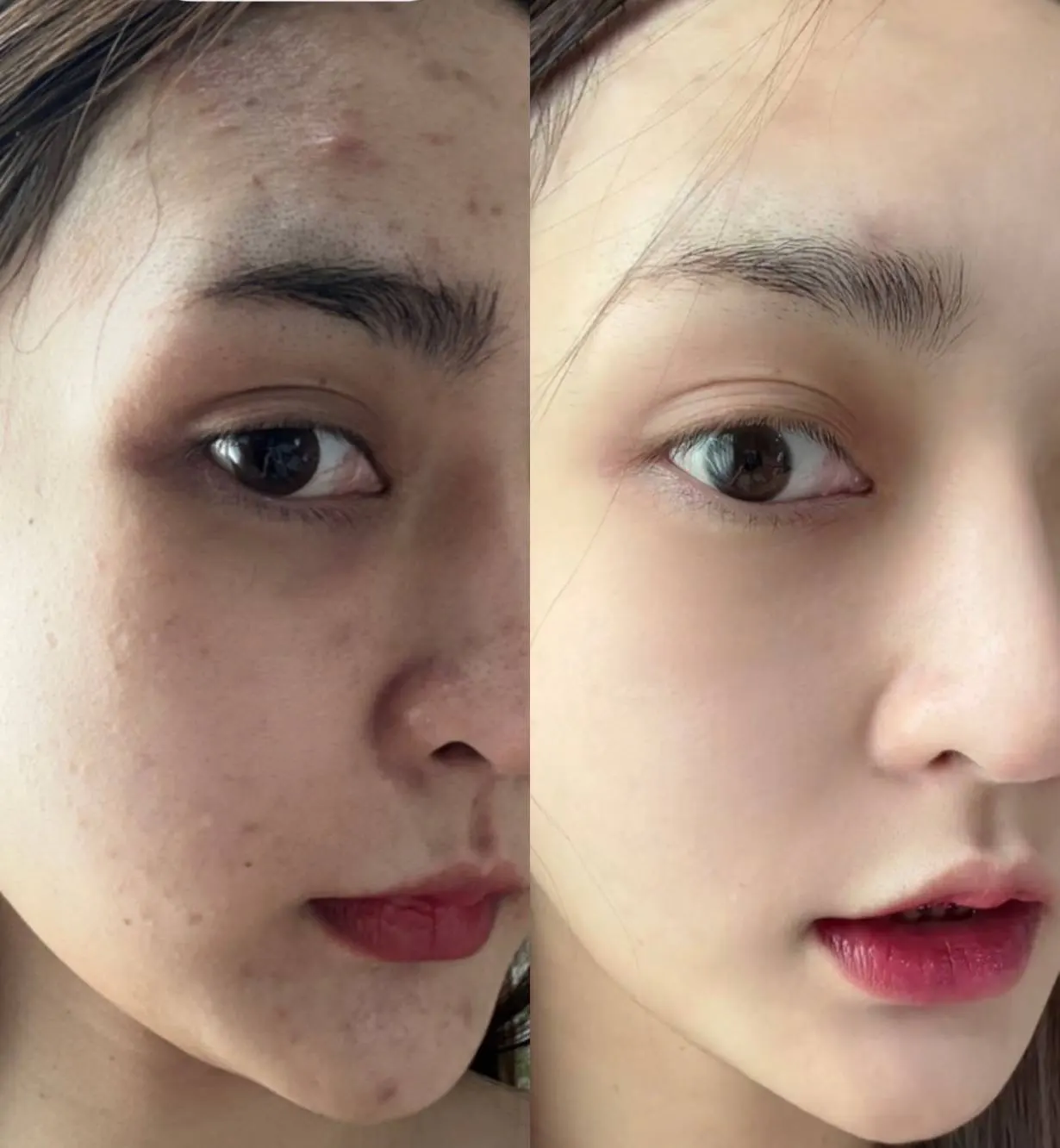 รีวิว ลูกค้า ที่ใช้ Mashu Collagen Plus (5)