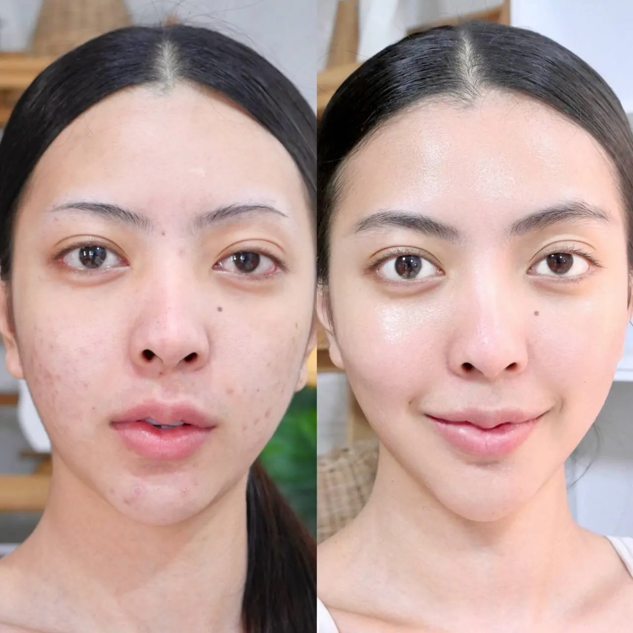 รีวิว ลูกค้า ที่ใช้ Mashu Collagen Plus (7)