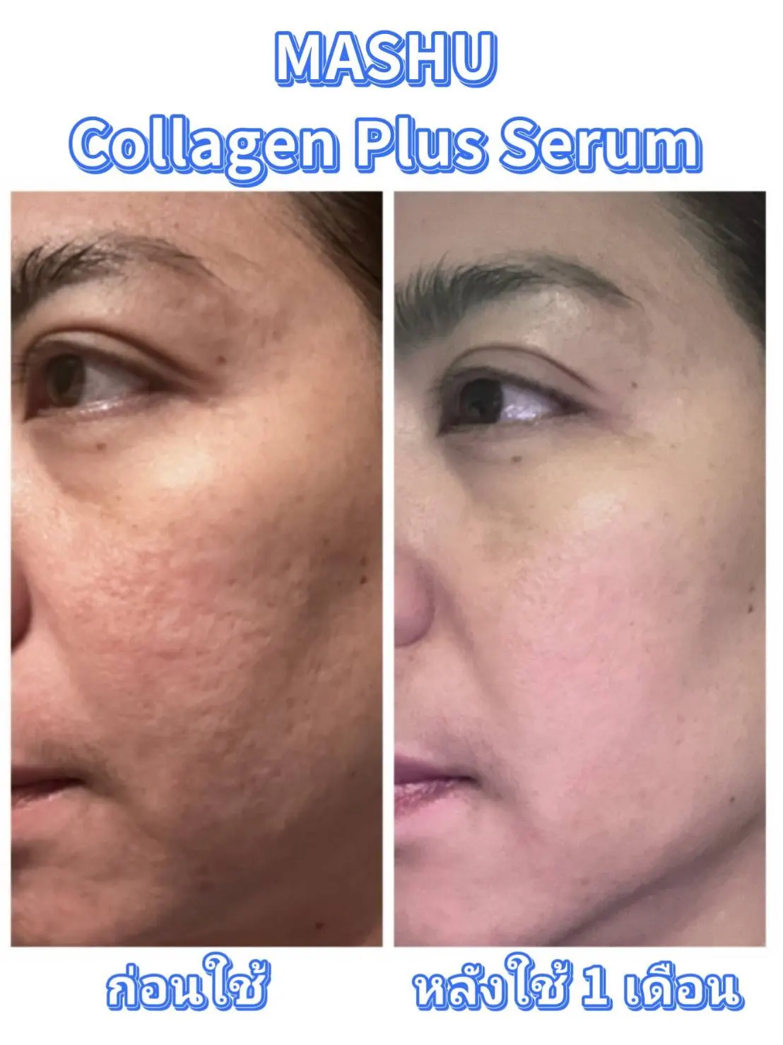 รีวิว ลูกค้า ที่ใช้ Mashu Collagen Plus (8)