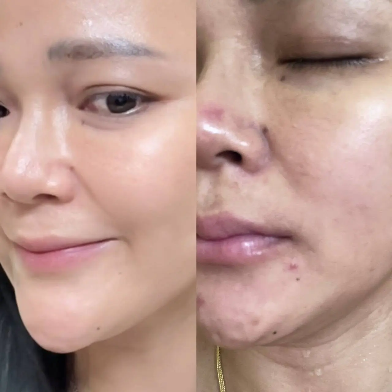 รีวิว ลูกค้า ที่ใช้ Mashu Collagen Plus (9)
